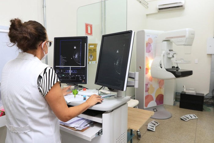 DF reduz fila de mamografia em mais de 70% com ampliação do serviço