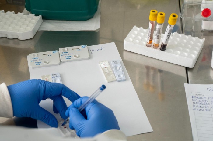 Novos pontos para coleta de exames em São Sebastião e Jardins Mangueiral