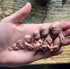 Eduardo Bolsonaro protocola projeto para sustar resolução do PT que defende aborto, maconha e mudança de sexo