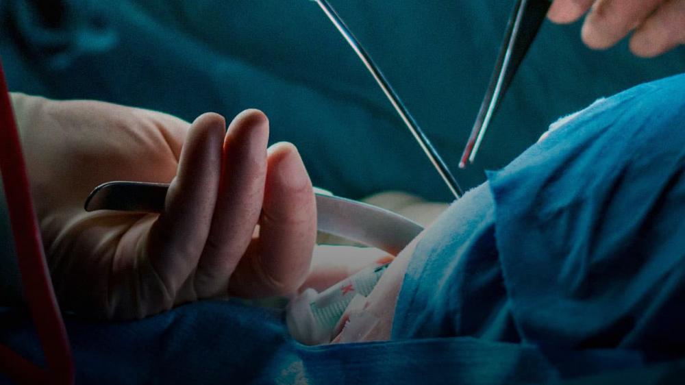 Mudança de sexo: arrependidos podem reverter a transição com cirurgia ‘trans transexualização’