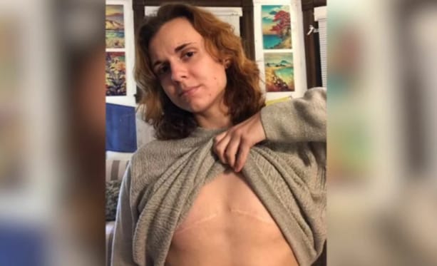 Redesignação de sexo: ex-trans processa clínica que removeu seus seios