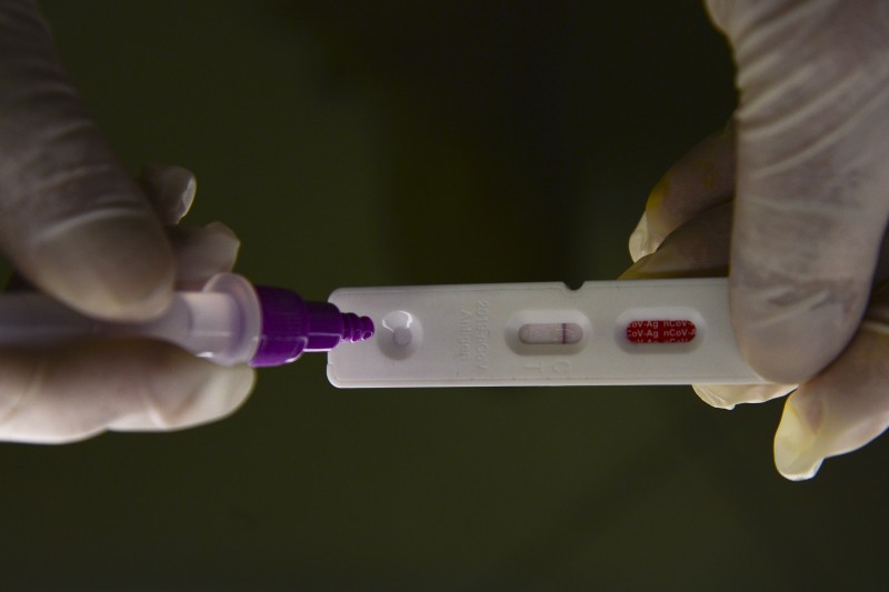 Casos de covid-19 no Rio de Janeiro aumentam 430% em uma semana