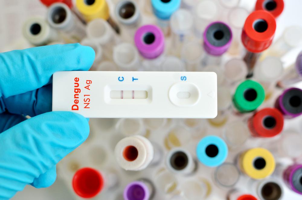 Procura por testes de dengue registra alta de 2.000% em farmácias