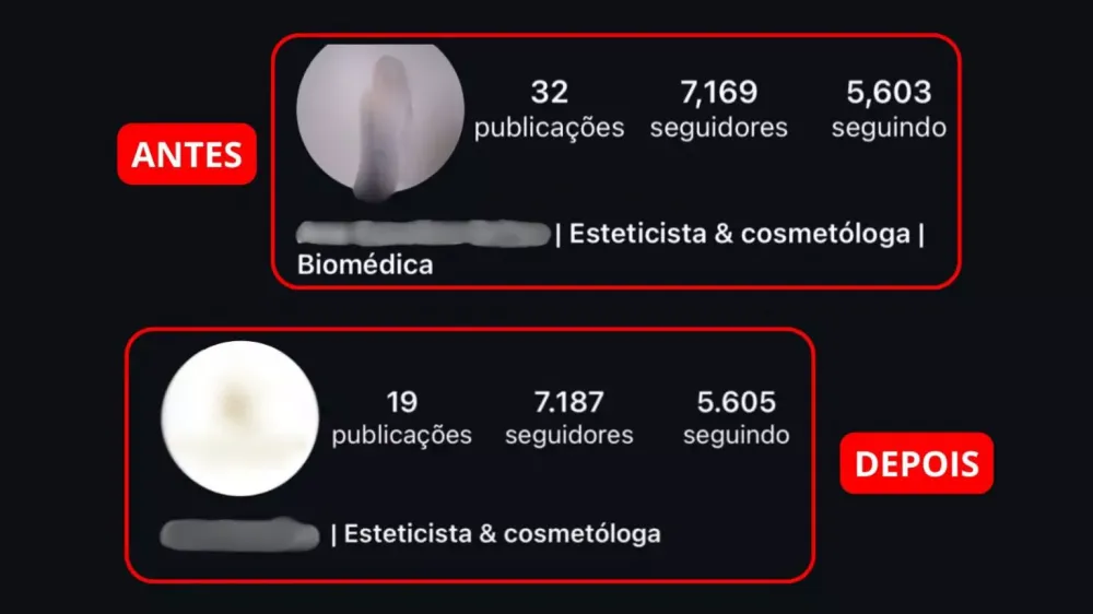 Estudante de Biomedicina altera perfil após denúncias de procedimentos estéticos irregulares