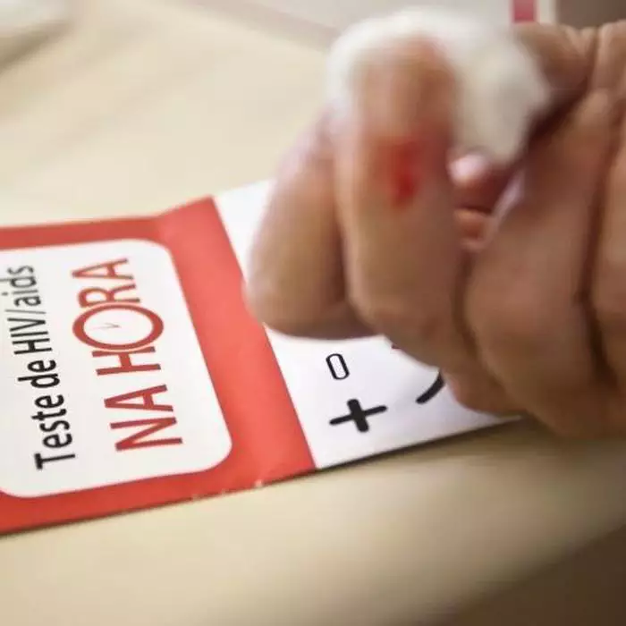 Aumento de casos de HIV e AIDS no Brasil: Jovens e populações vulneráveis ​​são mais afetados