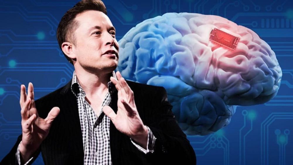 Musk está em busca de voluntários para implantar o chip