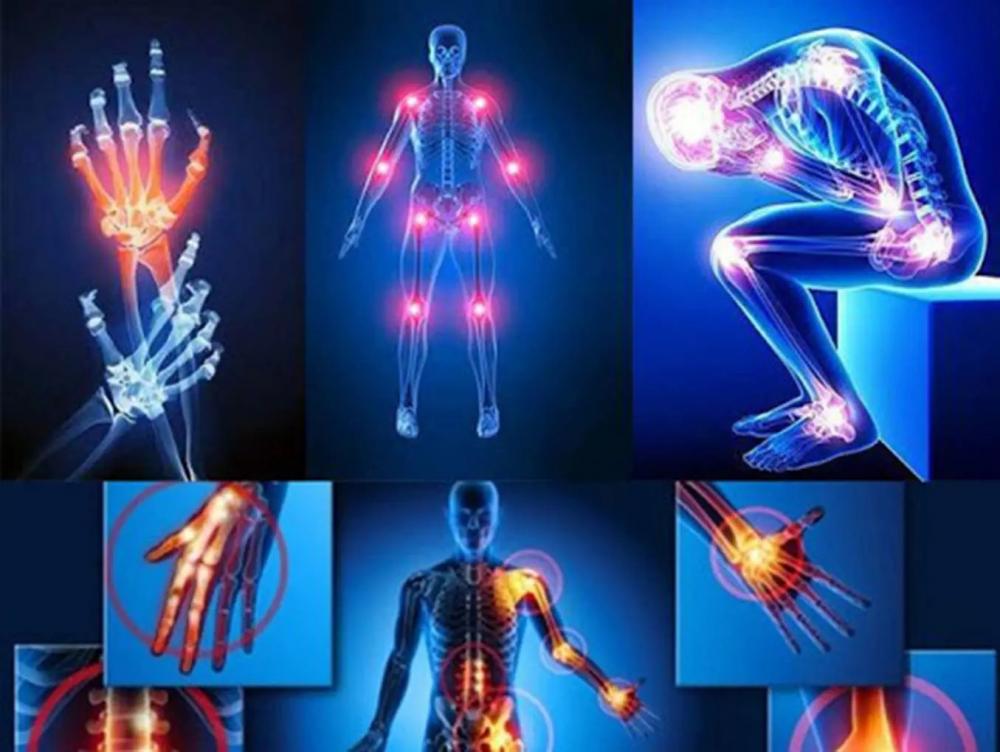 Pessoas com sequelas da Covid-19 estão 57% mais propensas a serem sedentárias